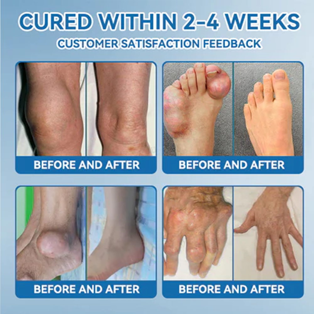 LBMLBM™ BPC-157 Joint Healing Cream FDA Certified (Targets arthritis, nerve pain, rheumatism & sports-related stiffness for better mobility)