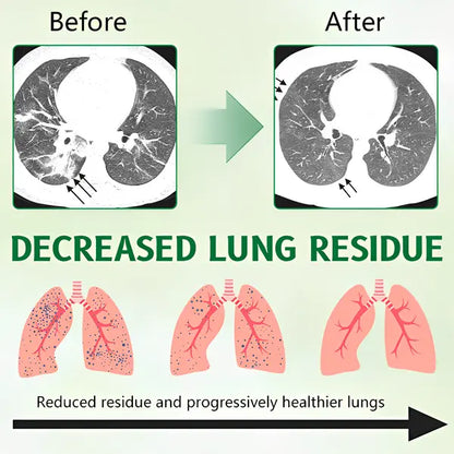 🌿 ODEIUN® 3X Concentrated Mullein Lung Cleanse Spray — Advanced Respiratory Detox & Clear Breathing