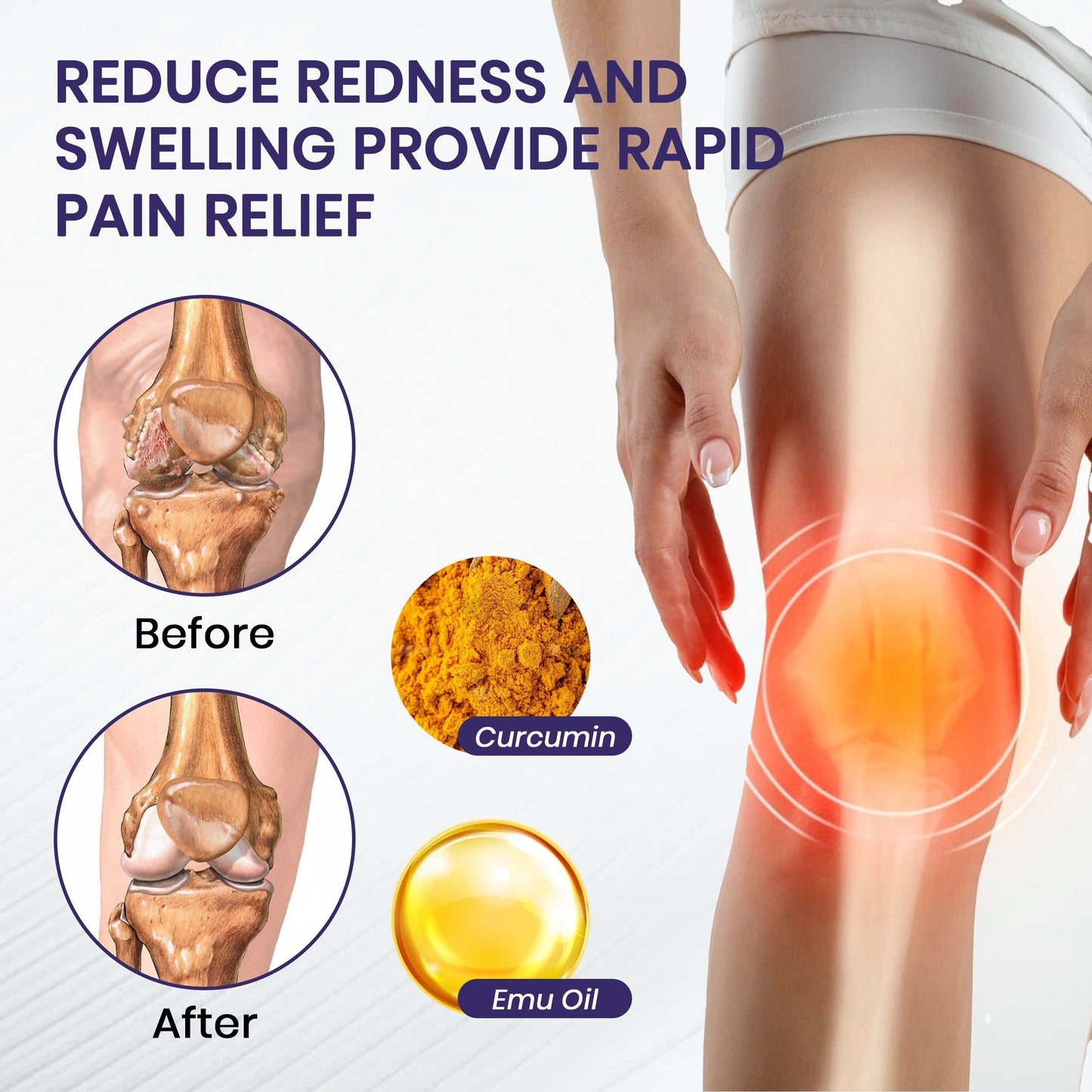 2025 New Upgrade Seurico™ Turmeric & Emu Oil Arthritis Soothing Pain Relief Massage Gel