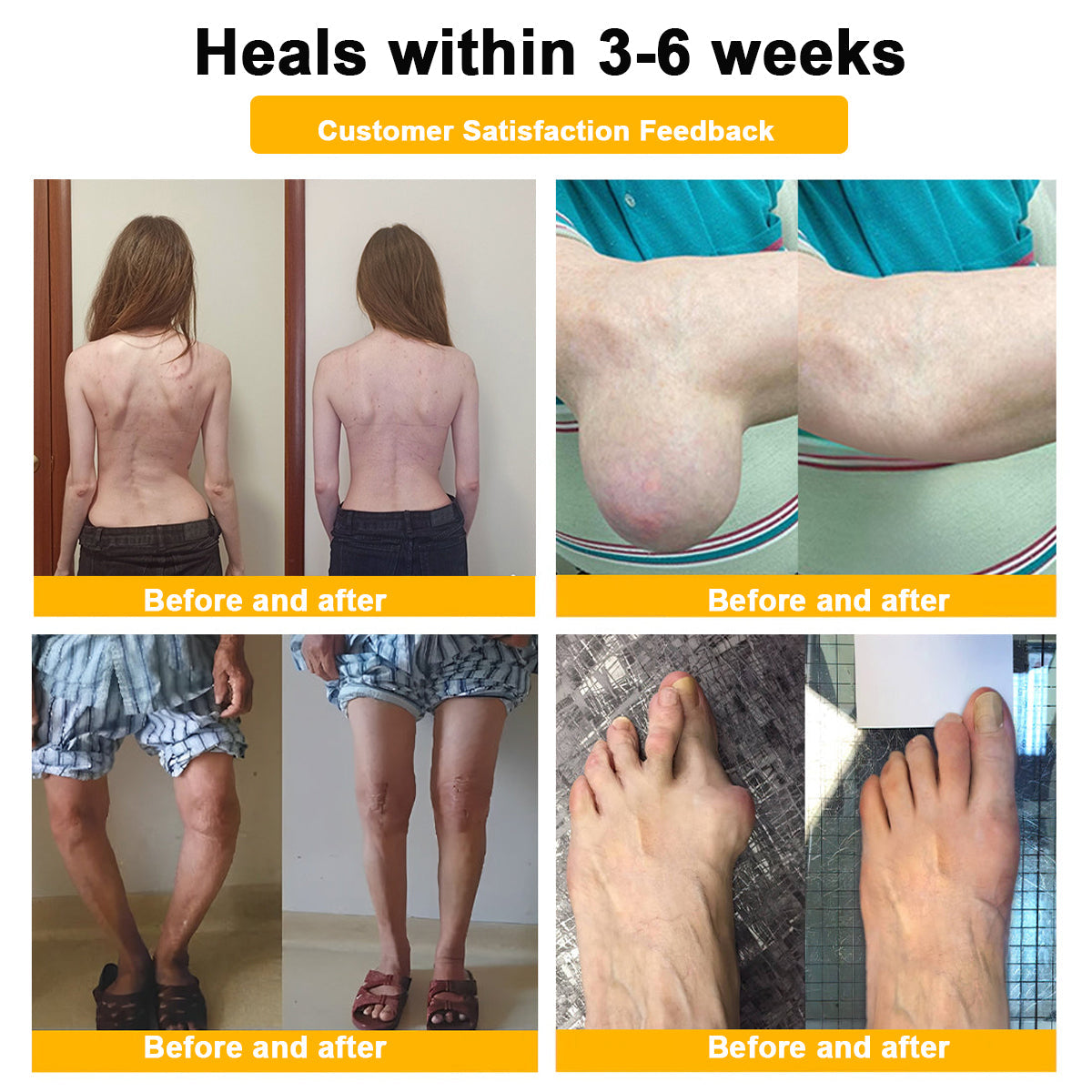 🎁Flash Sale - ODALIT™ Botulinum Toxin & Bee Venom Pain-Relief Bone Healing Cream