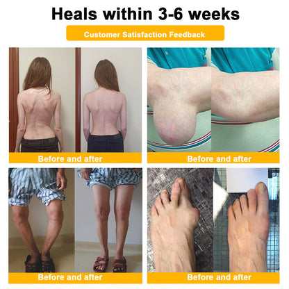 🎁Flash Sale - ODALIT™ Botulinum Toxin & Bee Venom Pain-Relief Bone Healing Cream