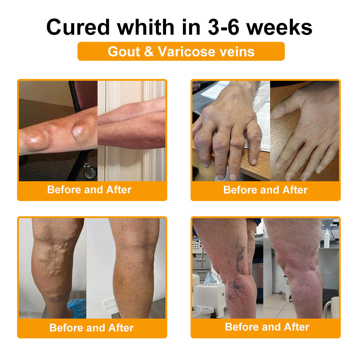 🎁Flash Sale - ODALIT™ Botulinum Toxin & Bee Venom Pain-Relief Bone Healing Cream