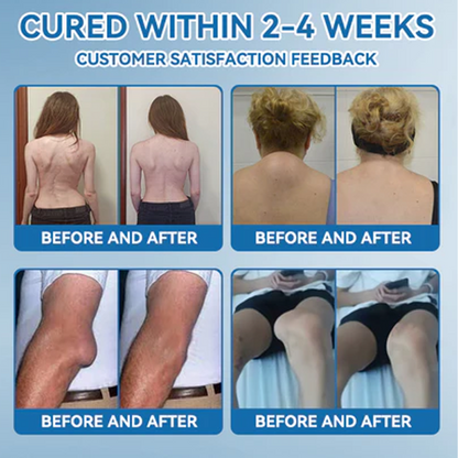 LBMLBM™ BPC-157 Joint Healing Cream  FDA Certified (Targets arthritis, nerve pain, rheumatism & sports-related stiffness for better mobility)