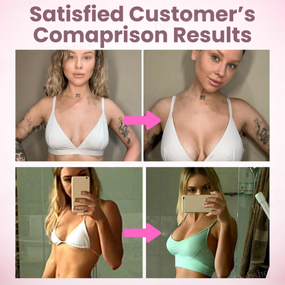 Negusy™ Breast Enhancement Nano Patch — Naturally Firm & Restore Youthful Curves