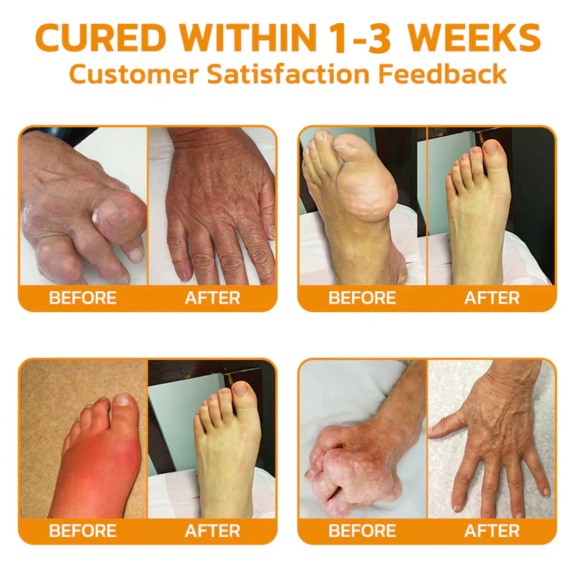 ✅ Negusy™ Lidocaine Scar-Free Pain Relief Liquid – AAOS Approved 👨‍⚕️ Reduces Joint Pain, Swelling & Stiffness