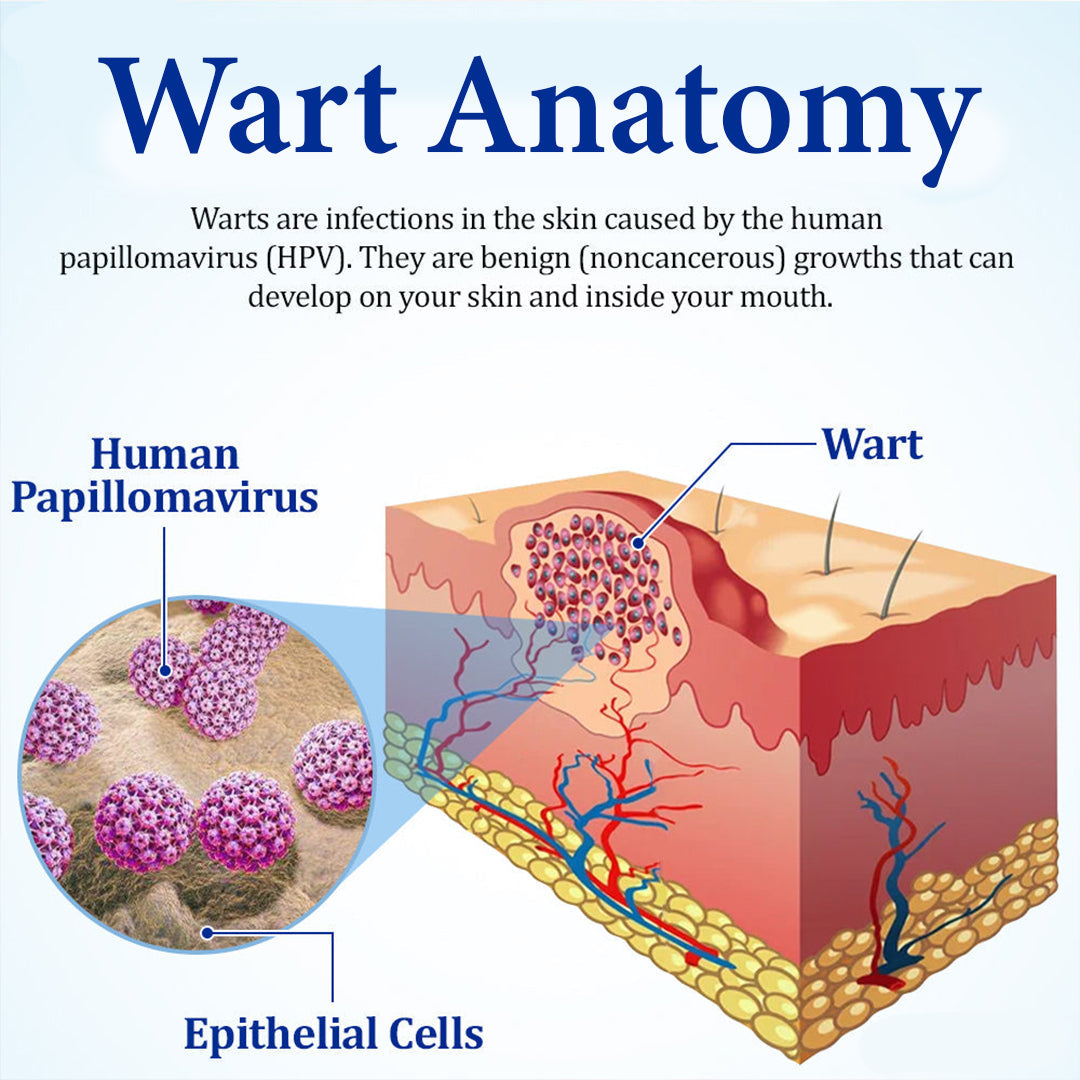 👩‍⚕️LBMLBM™ BeeDerm RX Cream, Painless, easy and gentle fix for warts, skin tags, lumps, infections, cysts and scars