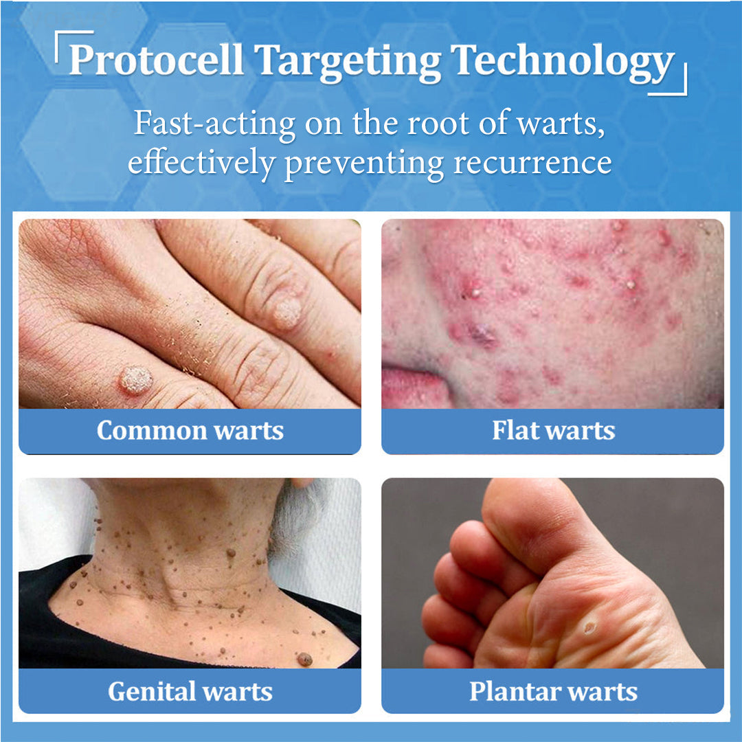 👩‍⚕️LBMLBM™ BeeDerm RX Cream, Painless, easy and gentle fix for warts, skin tags, lumps, infections, cysts and scars