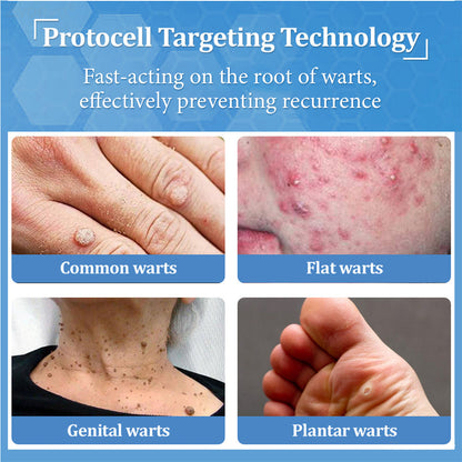 👩‍⚕️LBMLBM™ BeeDerm RX Cream, Painless, easy and gentle fix for warts, skin tags, lumps, infections, cysts and scars