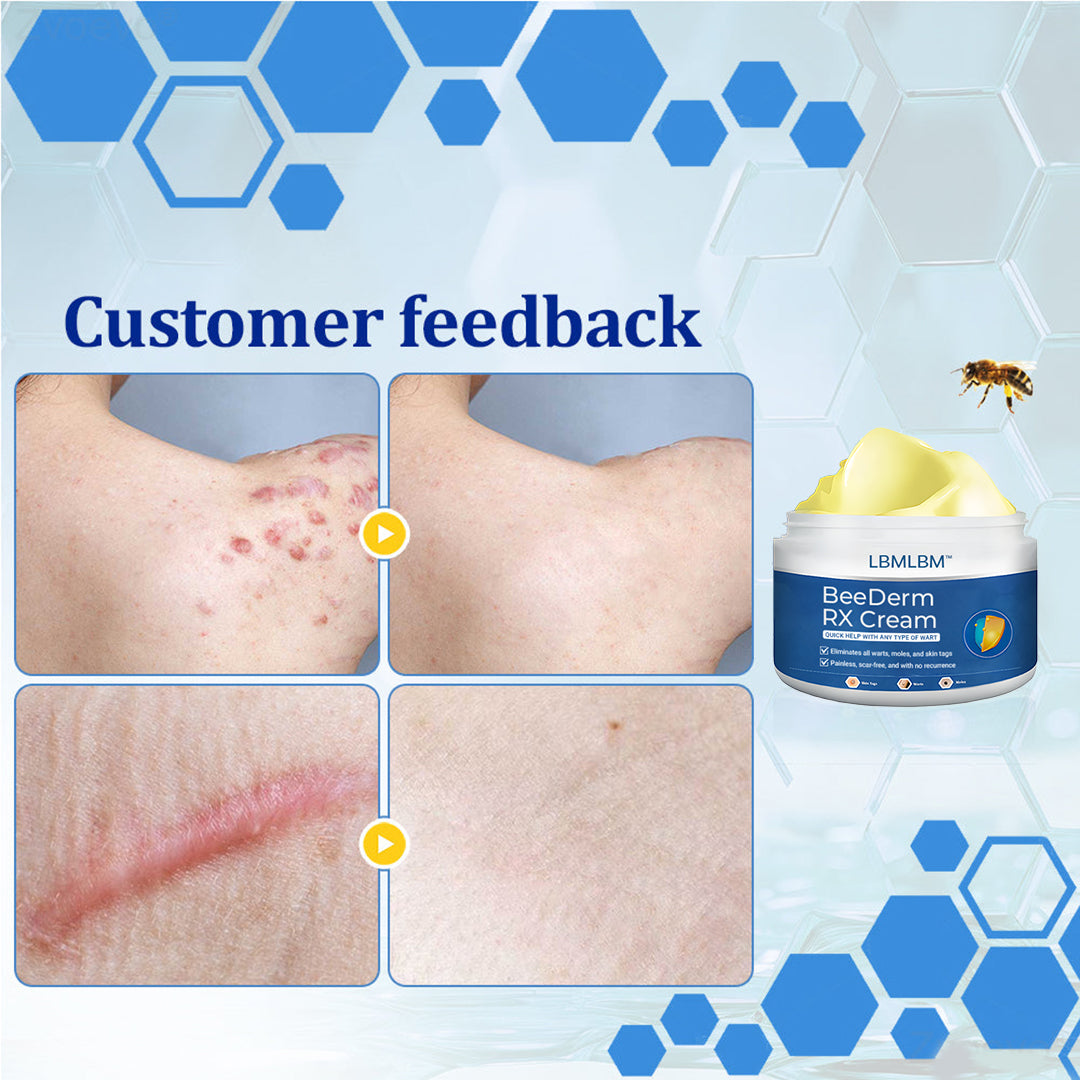 👩‍⚕️LBMLBM™ BeeDerm RX Cream, Painless, easy and gentle fix for warts, skin tags, lumps, infections, cysts and scars