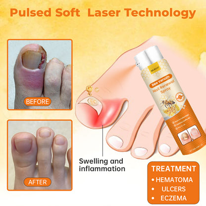Seurico™ Nail Renewal Spray – AAD-Certified Formula with Healing Bee Venom