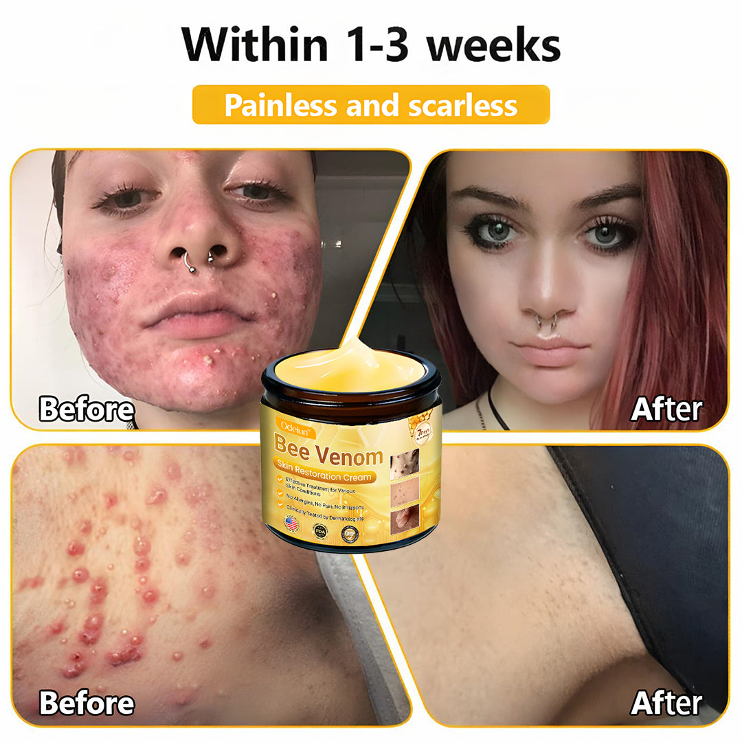 ✨ ODEIUN™ Bee Venom Skin Restoration Cream - Revitalize & Renew Your Skin Naturally! 🌿🐝