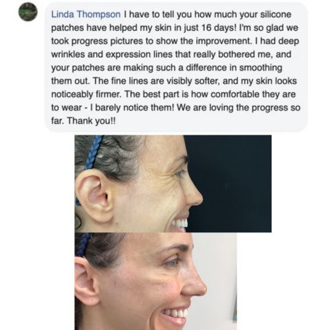 Seurico™ -Silicone Scar Care Sheets🔥