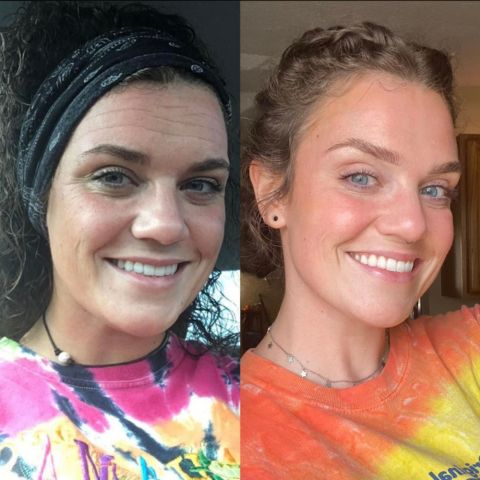 Seurico™ -Silicone Scar Care Sheets🔥