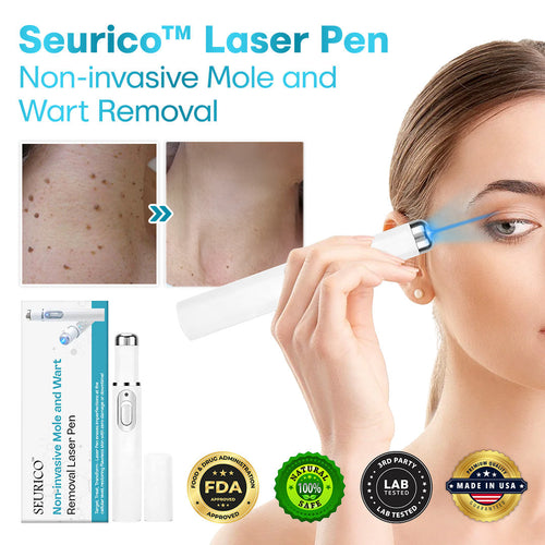 Seurico™ Laser Pen – Non-Invasive Mole and Wart Removal 1–3 days