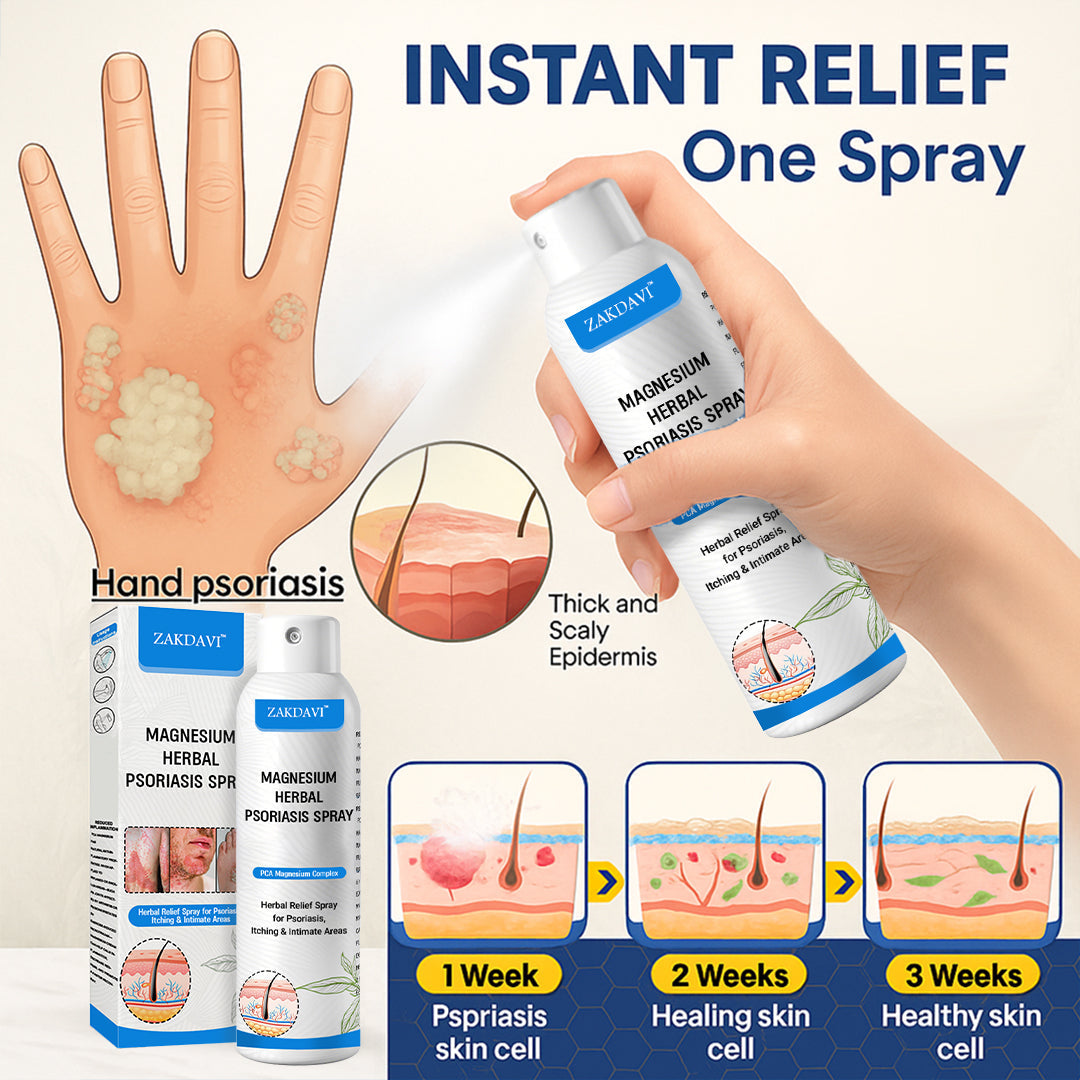 ✅Official Store:  Zakdavi™ Magnesium Herbal Psoriasis Spray – FDA Certified Relief for Psoriasis, Eczema & Skin Tags