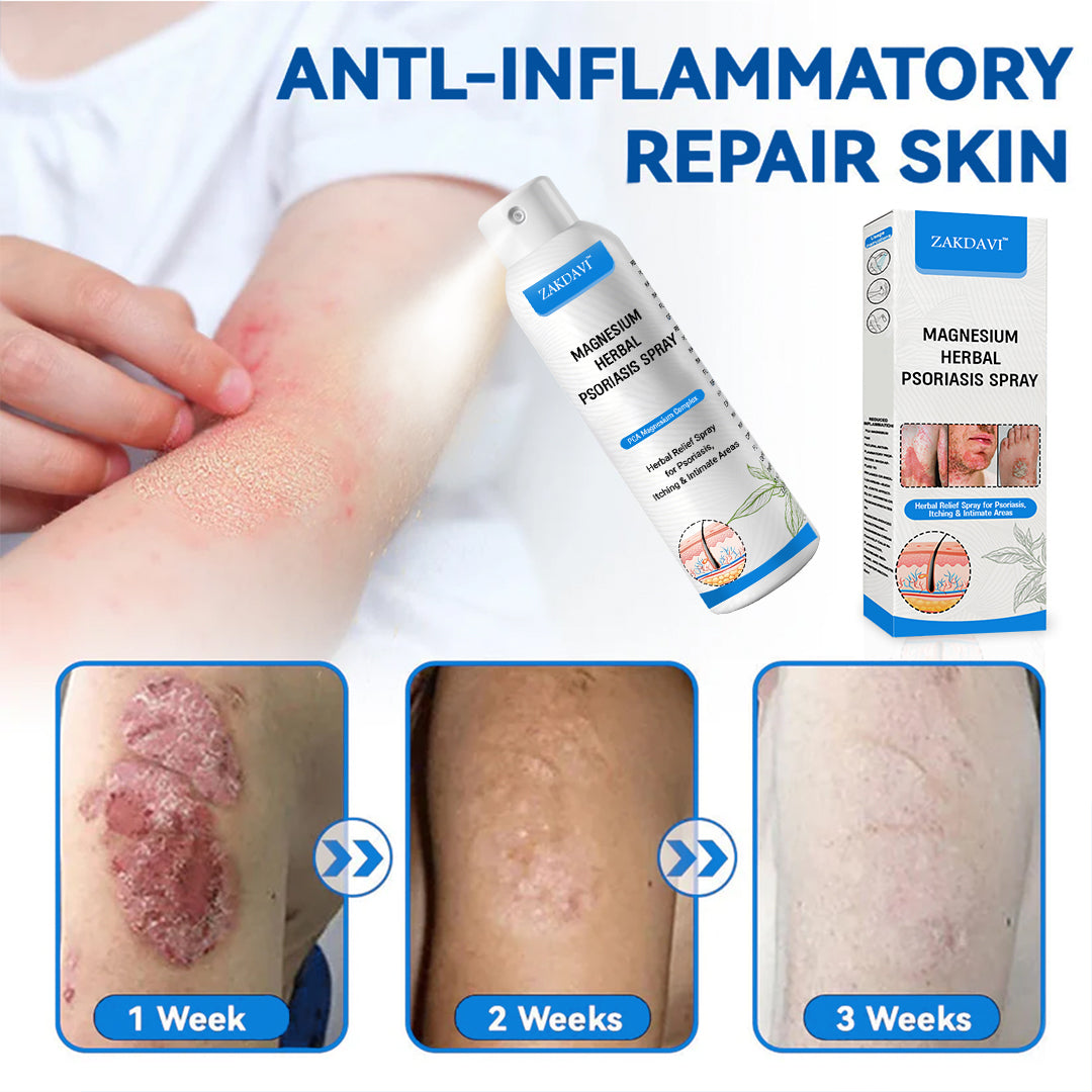 ✅Official Store:  Zakdavi™ Magnesium Herbal Psoriasis Spray – FDA Certified Relief for Psoriasis, Eczema & Skin Tags
