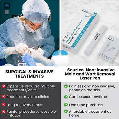 ✨Seurico™ Laser Pen - Non-invasive Mole and Wart Removal