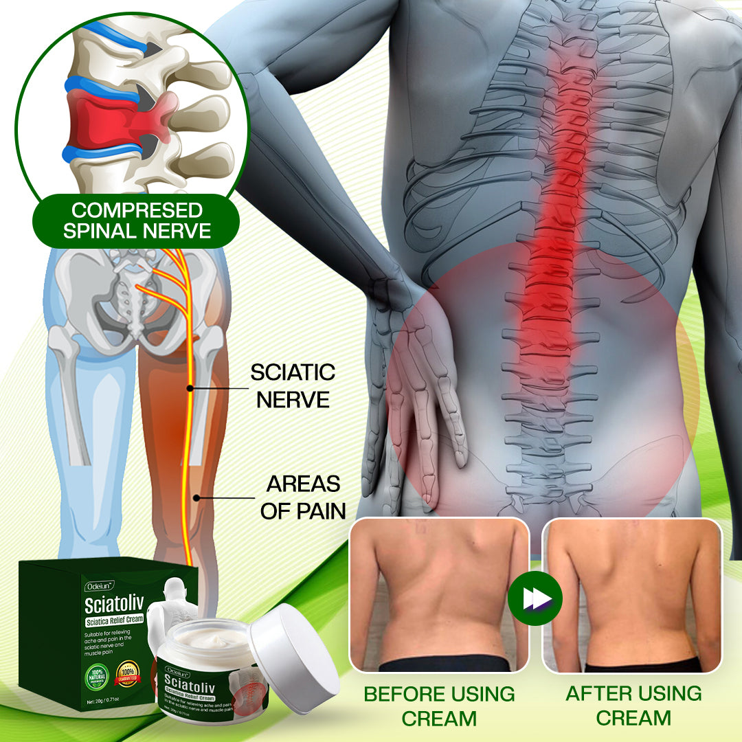 ✨ ODEIUN™ Sciatoliv Sciatica Relief Cream – Soothe Nerve Pain & Restore Mobility 💚